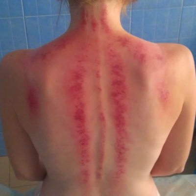 Gua Sha